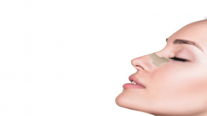 چسب زدن بینی بعد از رینوپلاستی