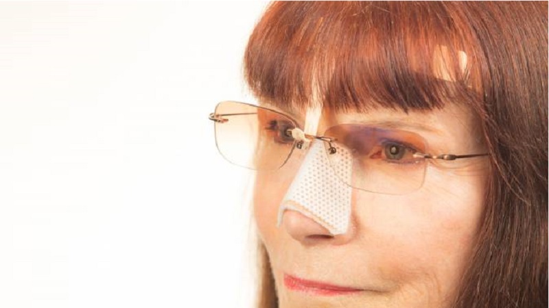 زمان گذاشتن عینک بعد از عمل بینی