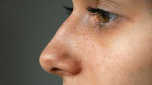 معایب و مزایای پوست نازک و ضخیم در عمل بینی