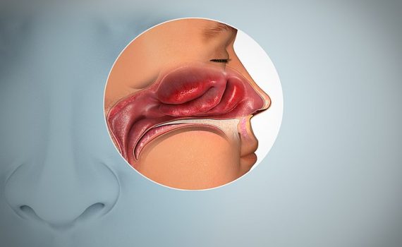 تشخیص و درمان التهاب بینی | جراح بینی اصفهان