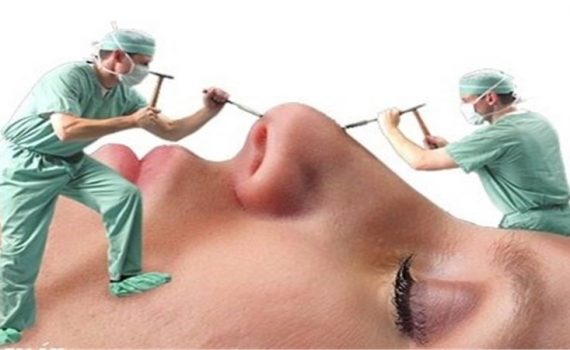 تغییرات روانی پس از عمل جراحی بینی | جراح بینی اصفهان | دکتر اصغر معمار زاده