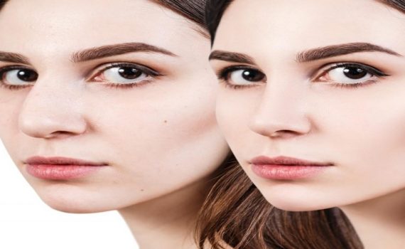 جراح بینی اصفهان | دکتر اصغر معمار زاده