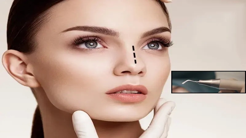 تکنیکهای نوین جراحی بینی ۲۰۲۵ | جراح بینی اصفهان | دکتر اصغر معمار زاده