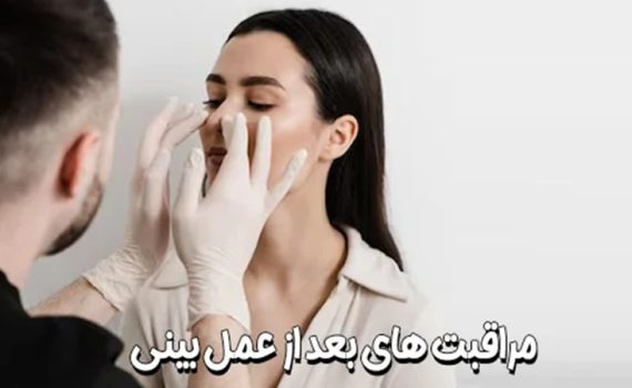 بهترین مراقبت‌های بعد از جراحی بینی | جراح بینی اصفهان | دکتر اصغر معمار زاده
