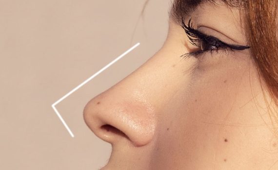 جراحی بینی طبیعی | جراح بینی اصفهان | دکتر اصغر معمار زاده