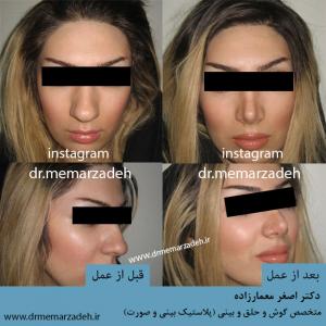 نمونه عمل